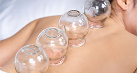 a woman experiencing Chinese cupping session